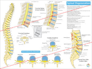 Spinal Degenration Poster