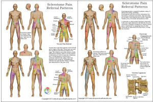 Body Pain Chart