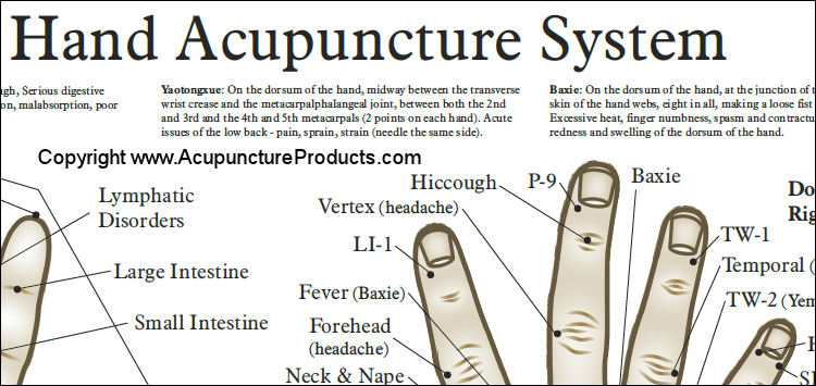 Chinese Hand Acupuncture Poster