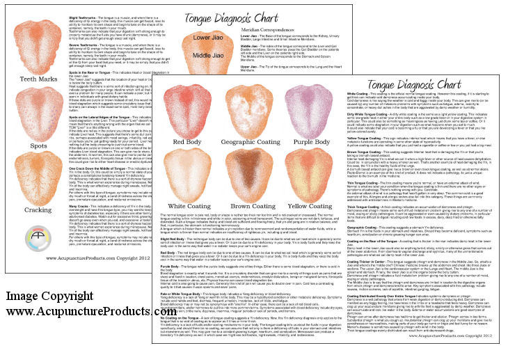 Chinese Tongue Diagnosis Chart