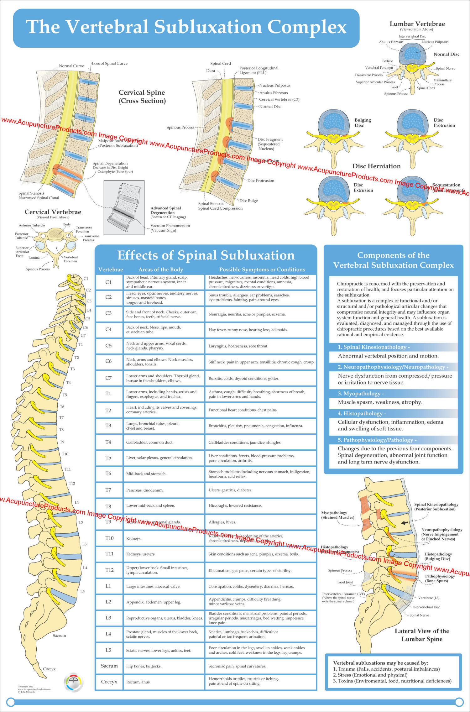 Chiropractic Spinal Nerves And Vertebral Subluxation Poster X My Xxx Hot Girl